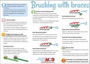 Brushing-with-braces-guide